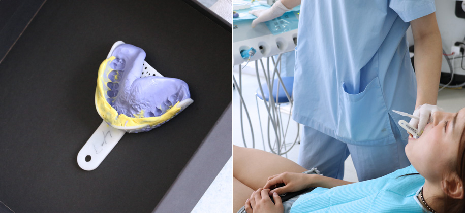 排龈、备牙、倒凹、调整咬合…为了让修复体使用更久、更美观，坚决杜绝毫厘偏差！